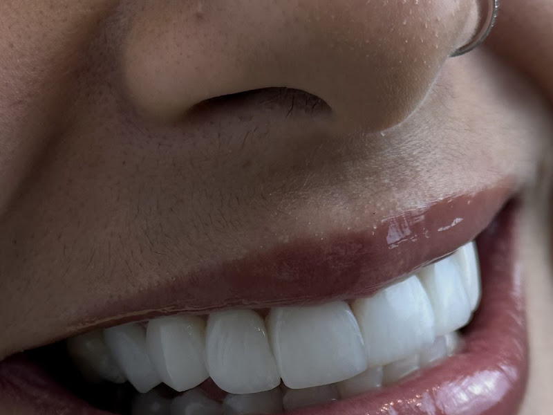 Foto de Clínica Dra. Mylena Bertaglia | Lentes em Resina Maringá