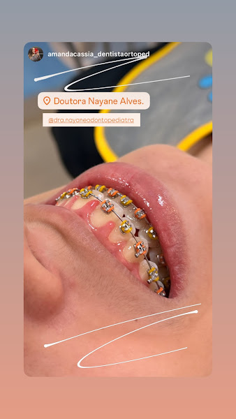 Foto 3 de Clínica Dra. Nayane Alves – Aparelhos Ortopédicos, Ortodônticos e Atendimento Infantil