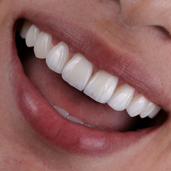 Foto 3 de Clínica Dra. Thaiara Bauer | Clínica Odontológica | Implantes - Próteses - Lentes - Ortodontia - Odontopediatria em Brusque