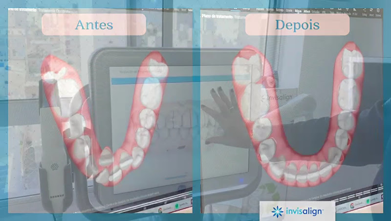 Foto 3 de Clinica Dra. Vivian Bertoglio - Odontologia & Harmonização em Rio Grande