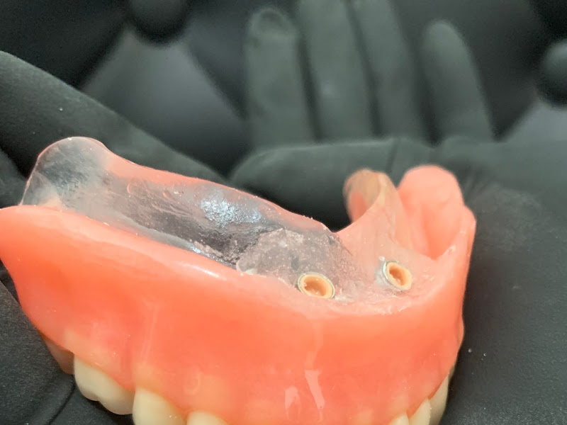 Foto 7 de Clínica Dutra Odonto | Implante Dentário | Lente de contato dental | Santo Agostinho | Volta Redonda - RJ