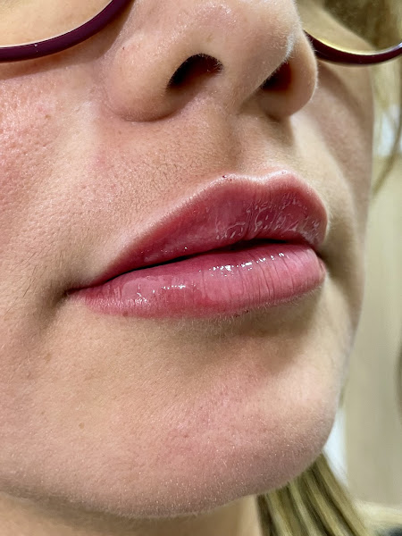 Foto 2 de Clínica Ellus Estética