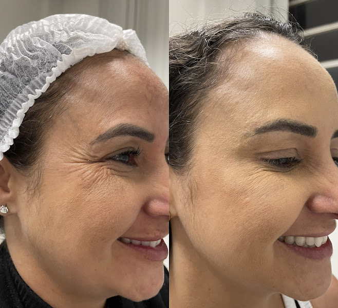 Foto 3 de Clínica Ellus Estética