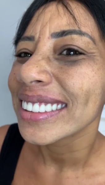 Foto 4 de Clínica EquipeDente | Invisalign | Implante Dentário | Nazaré | Belém - PA