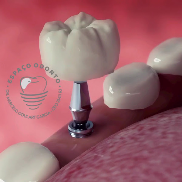 Foto 5 de Clinica ESPAÇO ODONTO