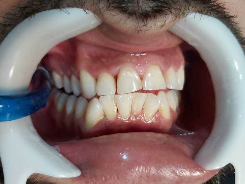 Foto 10 de Clínica Especialidades Odontológicas