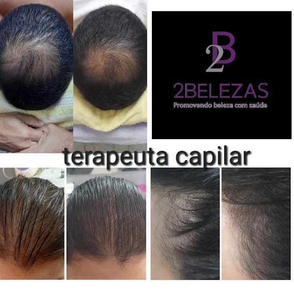 Foto 3 de Clínica Estética 2Belezas Recife Espinheiro:emagrecimento p/homens e mulheres,limpeza de pele,melasma,celulite,estrias.