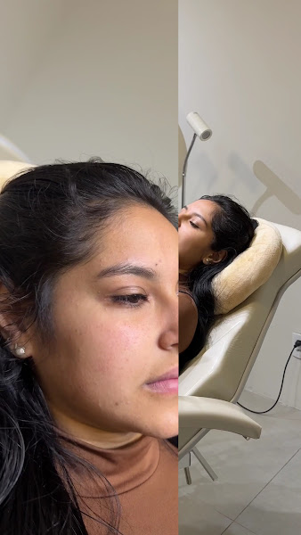 Foto 2 de Clínica Estética Avançada Drª. Luciana Vieira Coltri | Biomédica Esteta em Botucatu | Harmonização Facial e Corporal