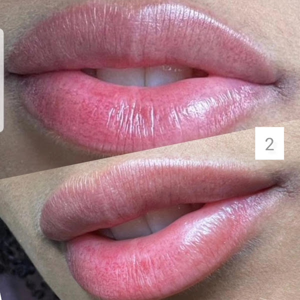 Foto 3 de Clinica Estetica BH