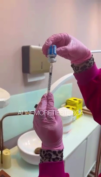 Foto 3 de Clínica Estética Dra. Aline Moreti em São Caetano do Sul - SP, Microagulhamento, Jato de Plasma, Peeling, Botox, Fios de PDO