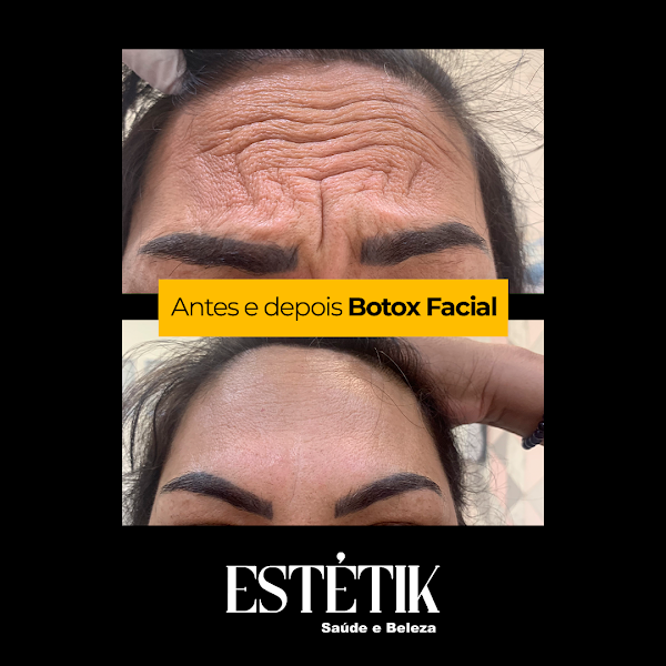 Foto 2 de Clínica Estétik - Saúde e Beleza | Emagrecimento | Estética Facial e Corporal em Jacareí
