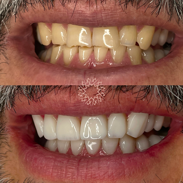 Foto 3 de Clínica Farinelli - Lentes em resina | Tucuruvi - SP