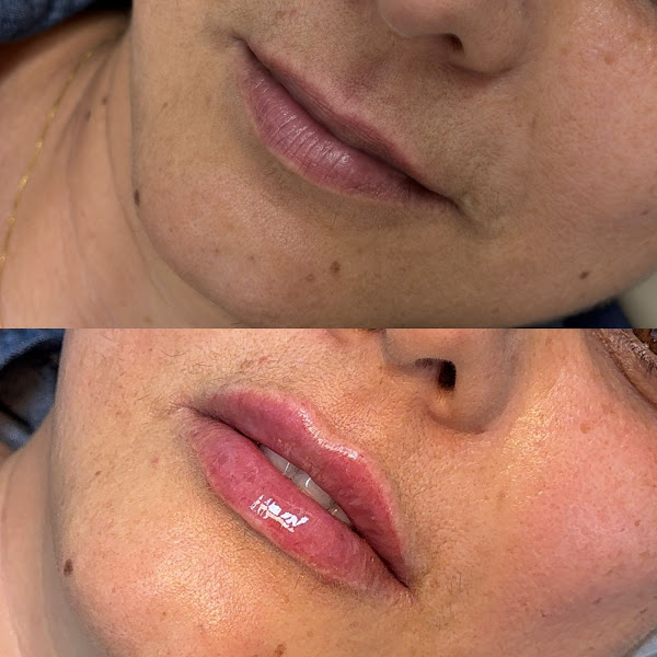 Foto 3 de Clínica Fernanda Almeida | Harmonização Facial e Corporal em São Paulo