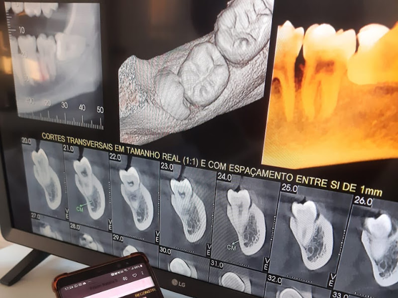 Foto 9 de Clínica FMS Odontologia | Dentistas em Porto Alegre | Implantes | Ortodontia | Rio Branco