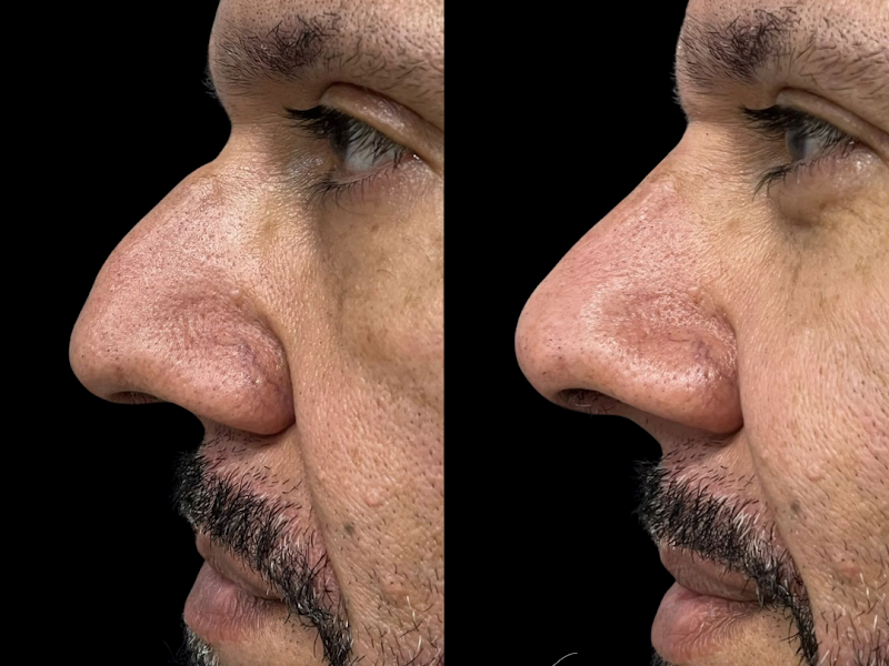 Foto 3 de Clínica Foye | Dentista | Implante Dentário | Alinhador | Lente de Contato | Preenchimento Labial | Botox | Rinomodelação