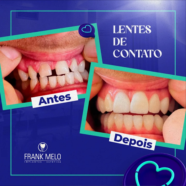 Foto 2 de Clínica Frank Melo | Odontologia e Estética em Trindade
