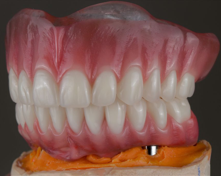 Foto 3 de Clínica Fritzen Implantodontia em Palhoça