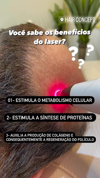 Foto 3 de CLINICA HAIR CONCEPT - TRANSPLANTE CAPILAR FUE MOSSORÓ