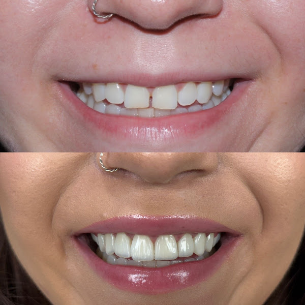 Foto 3 de Clinica Harmoniê Dental Care