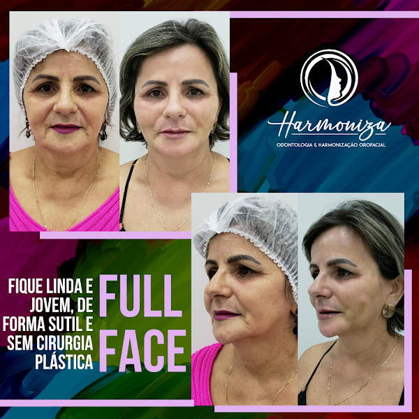 Foto 3 de Clínica Harmoniza - Dra. Gabriela Vieira