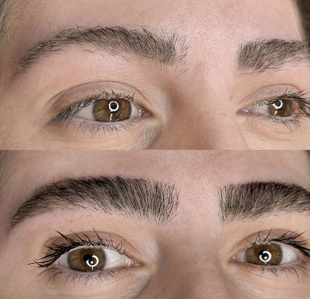 Foto 3 de Clínica Heaven - Parnaíba