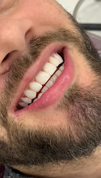 Foto 4 de Clínica Henrique Jorge odontologia e saude | Granja Portugal | Dentista |