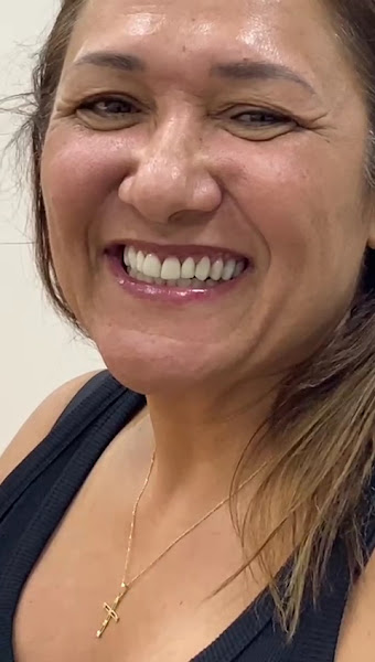 Foto 3 de Clínica Hingrid Maia | Facetas em resina | Botox em Niterói