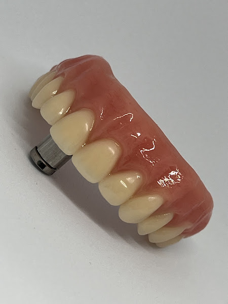 Foto 2 de Clinica HR Odontologia | LENTES EM RESINA | IMPLANTE DENTÁRIO