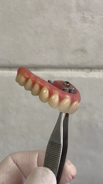 Foto 3 de Clinica HR Odontologia | LENTES EM RESINA | IMPLANTE DENTÁRIO