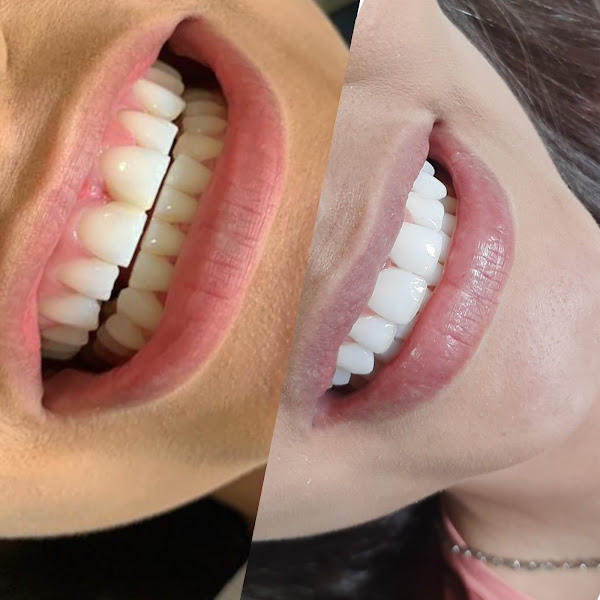 Foto 2 de Clínica Idealy Odontologia Estética - São José do Rio Preto