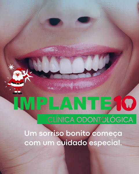 Foto 3 de Clínica Implante 10 DR. Thiago Brandão