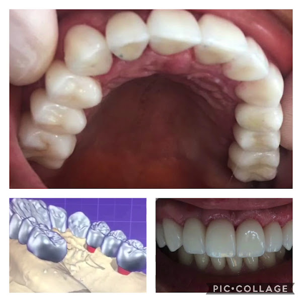 Foto 3 de Clínica Implante Dentes