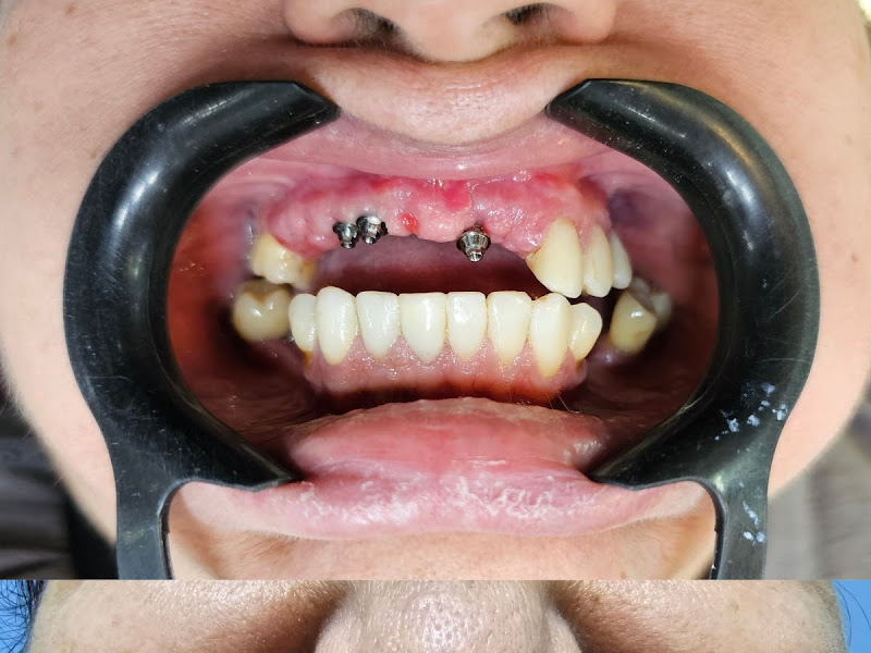 Foto 3 de Clínica Implante Grande Rio