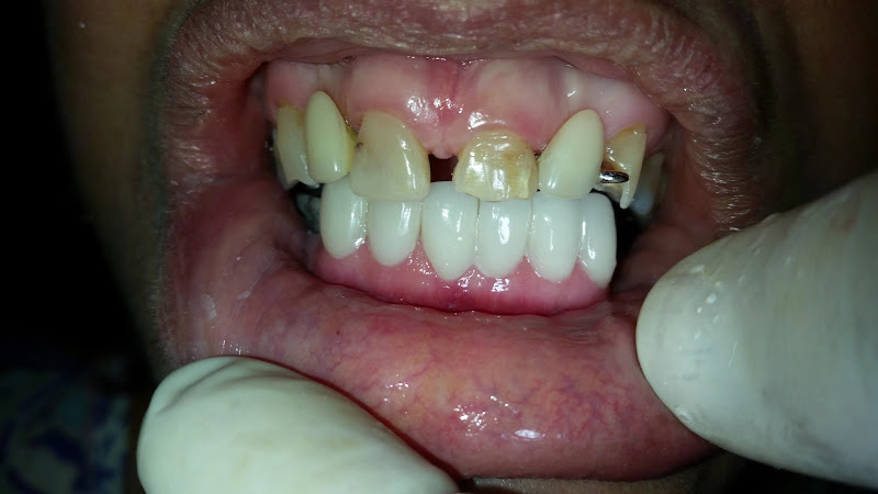 Foto 3 de Clínica Implantes Bruno Cronemberger