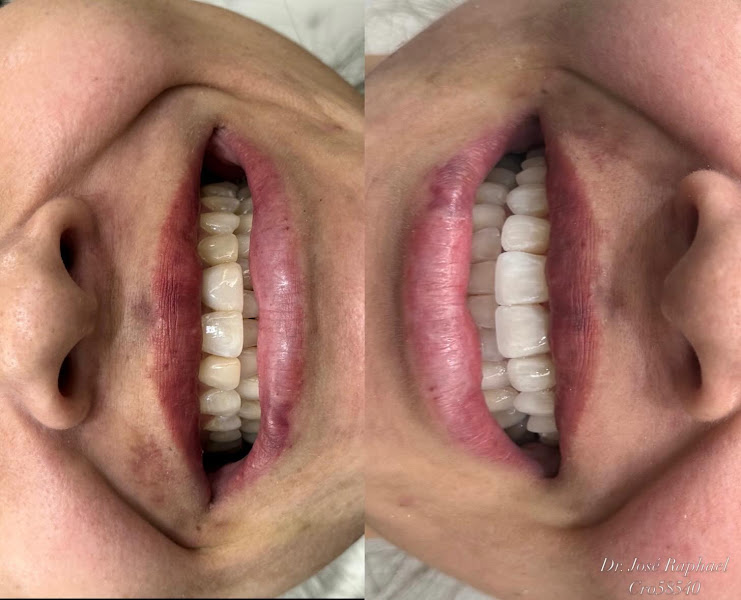 Foto de Clínica Integrare - Implantes dentários no Recreio dos Bandeirantes | Facetas de resina no Recreio dos Bandeirantes