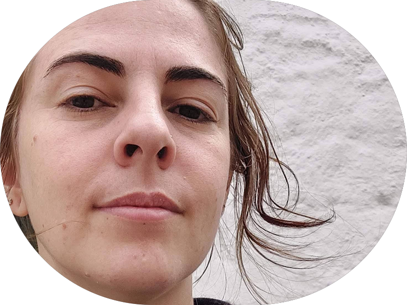 Foto 4 de Clínica Irradie | Implantes dentários em Criciúma | Harmonização facial em Criciúma