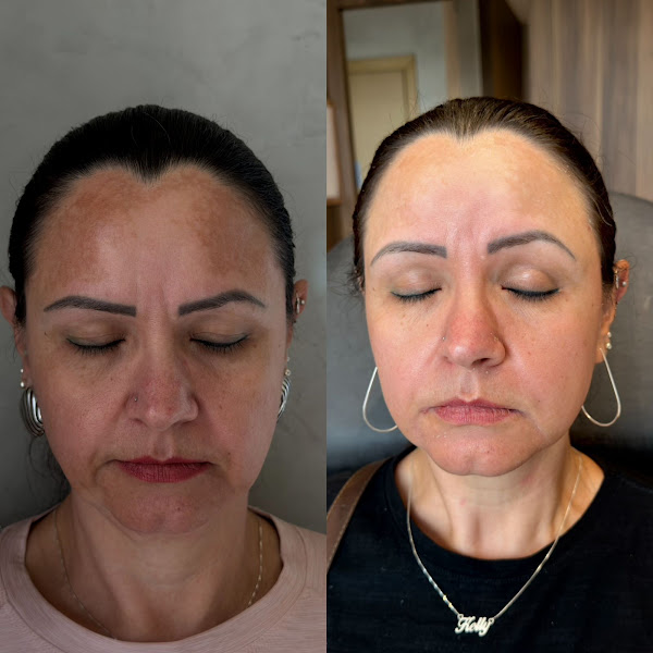 Foto 3 de Clinica Janaina Folquesatto | Referência em Acne e Melasma em Campo Grande/MS