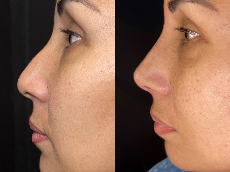 Foto 3 de Clinica Jane Centre De Esthétique