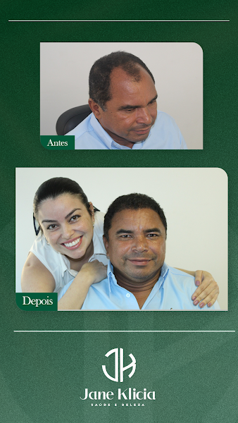 Foto 3 de Clínica JK - Transplante Capilar e Cirurgia Estética Facial