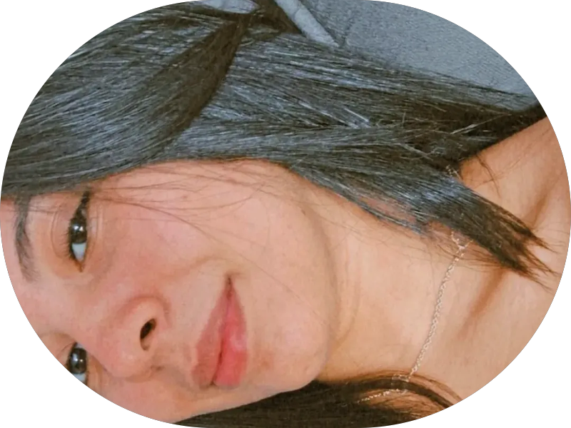 Foto 5 de Clínica Juliana Guedes - Facetas de Resina, Lente de Contato Dental e Clareamento | Dentista em Natal RN