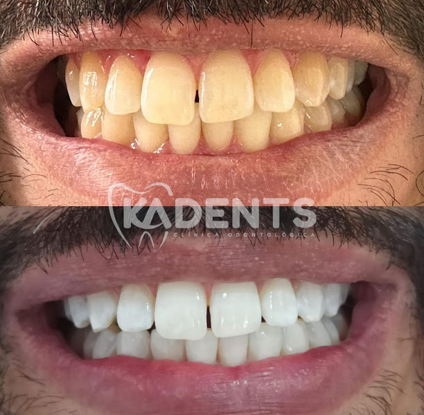 Foto 2 de CLINICA KADENTS | Consultório odontológico
