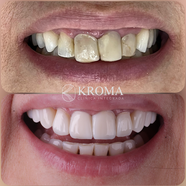 Foto 3 de Clínica Kroma | Implantes • Facetas • HOF • Medicina Geral | Dentista Nova Palhoça, Palhoça/SC
