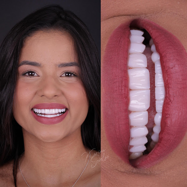 Foto 2 de Clínica ks odontologia Estética