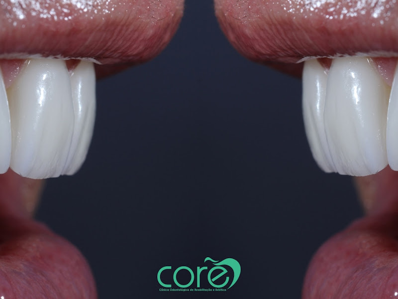 Foto 5 de Clínica L'or | Harmonização Facial e Corporal - Odontologia