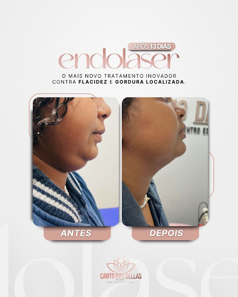 Foto 3 de Clínica Larissa Manso - Estética & Bem Estar | São João de Meriti RJ