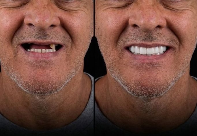 Foto 2 de Clínica Leal - Odontologia e Estética Avançada - Pindamonhangaba