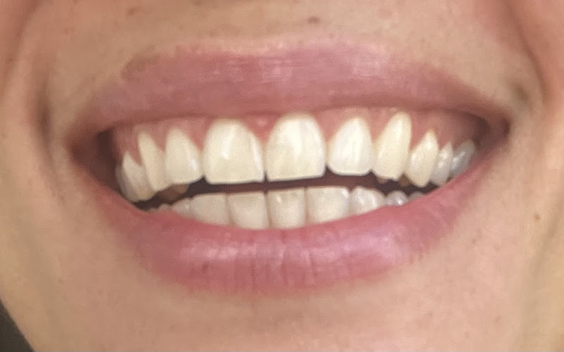 Foto 2 de Clínica Lenyse Alelaf - Endodontia em Teresina - Tratamento de canal dentário
