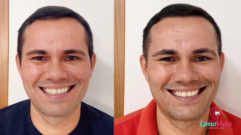 Foto 4 de Clínica LimoVida