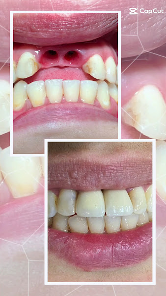 Foto 3 de Clínica Lina Odontologia Unidade Leme | Restauração | Cirurgia | Tratamento De Canal | Aparelho Dentário | Dentista Mais Próximo