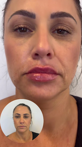 Foto 3 de Clínica Living - Estética Avançada e Nutrição Integrada